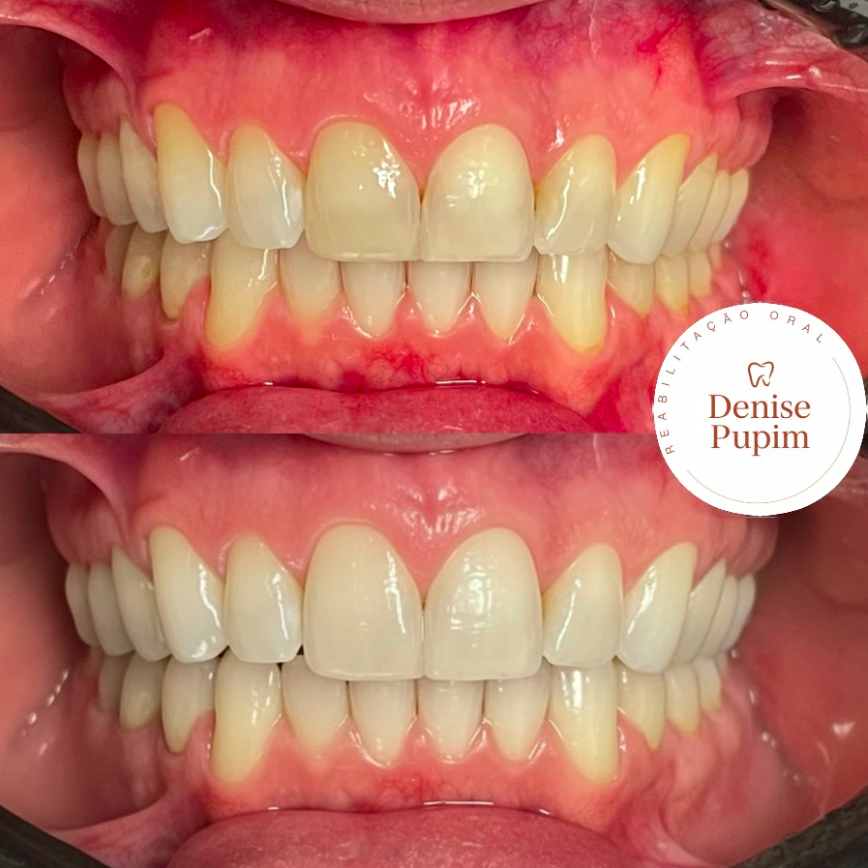 Denise Pupim Dentista - foto 1