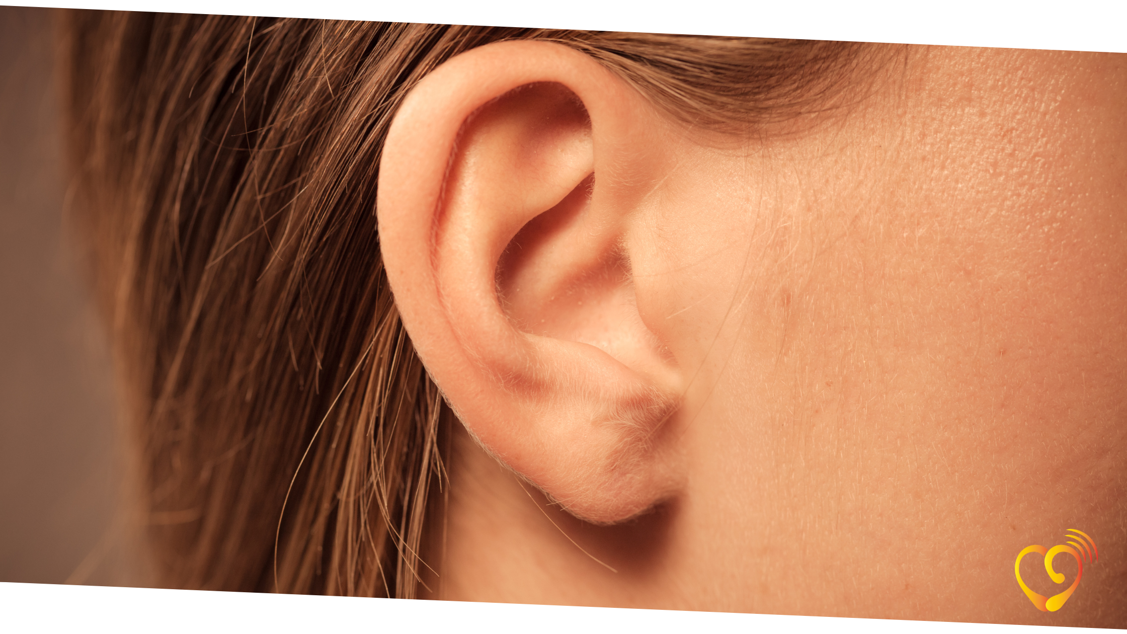 Uma orelha indicando perda auditiva unilateral